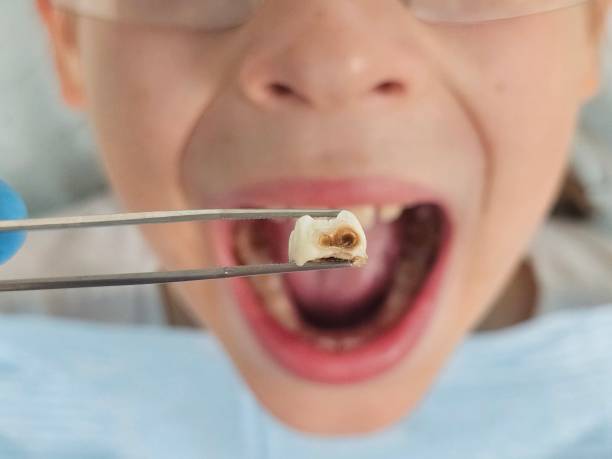 Best Pediatric Emergency Dentist in Utica, NY
